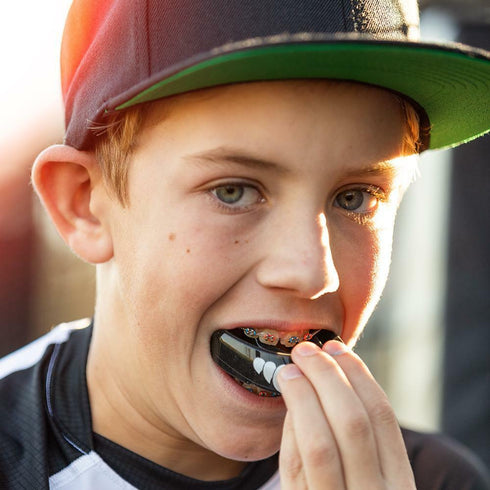 Double Braces Strapless Mouthguard
